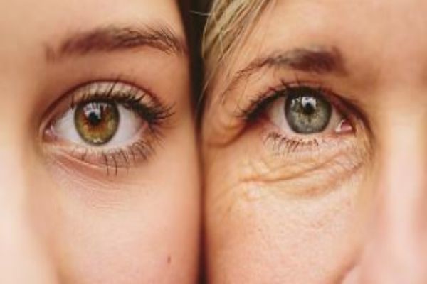 女人脸部显老的特点，女人脸部显老的原因