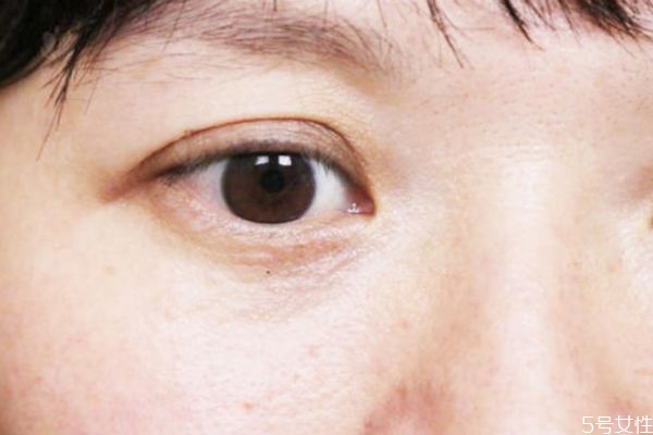 维生素e加凡士林可以去眼纹吗，维生素e加凡士林要洗吗