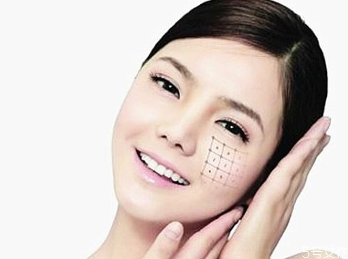 热玛吉可以去除双下巴吗，热玛吉能瘦脸吗