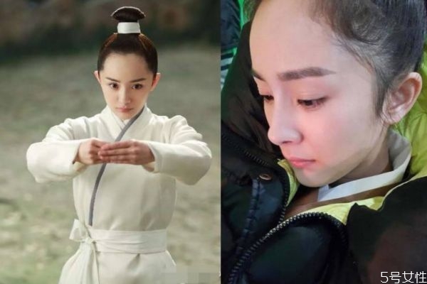 发际线后移如何预防，如何防止发际线继续后移