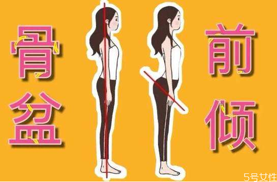 骨盆前倾是什么样子，怎么判断自己骨盆前倾