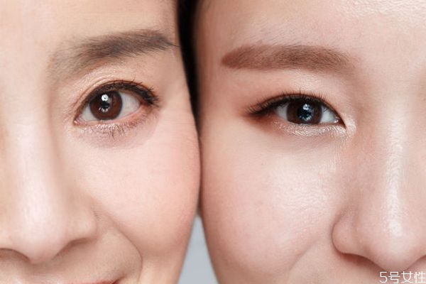 怎么有效的去除黑眼圈，如何淡化黑眼圈