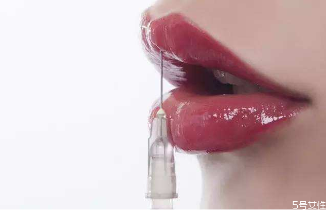 嘴唇打玻尿酸好不好，玻尿酸丰唇几天最好看