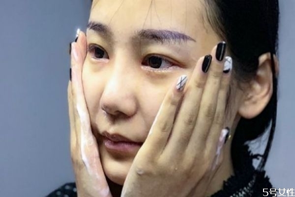 青春期皮肤变差怎么办，青春期应该怎么护肤