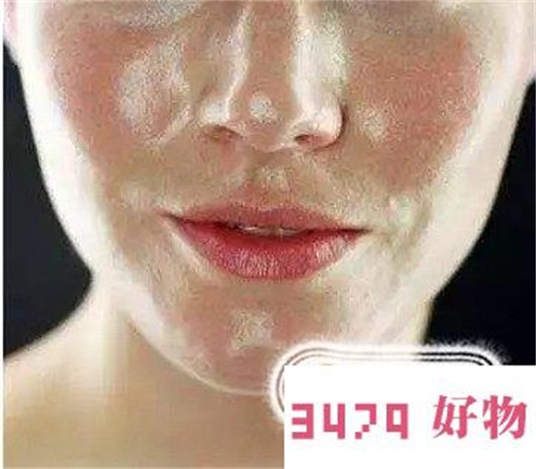 怎么判断脸上有螨虫，脸上有螨虫的症状