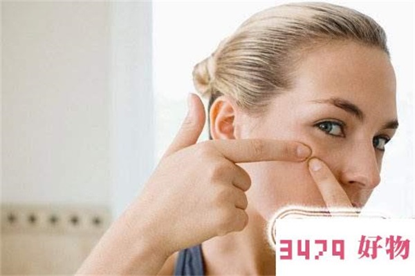 痘痘里面挤出来的白色东西是皮脂还是螨虫