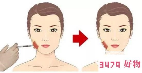 瘦脸针多少钱一针，瘦脸针能保持多久