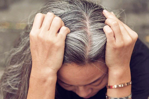 白头发要怎么预防，白头发要怎么改善