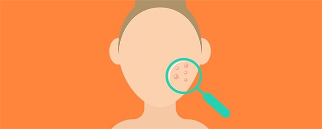 祛痘产品哪个品牌效果好