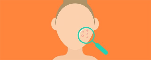 痘痘贴使用方法