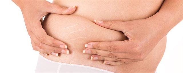 防止妊娠纹哪个牌子好