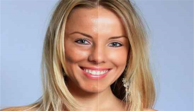 皮肤晒伤蜕皮怎么办，皮肤晒伤脱皮多久能好