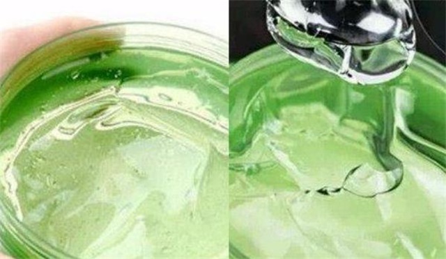 芦荟胶能去痘印吗，芦荟胶去痘印有用吗