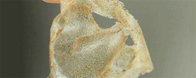 为什么用完撕拉面膜脸会痒