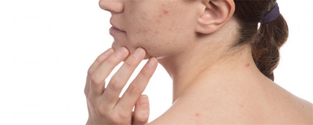 粉刺瘤会带来哪些伤害，粉刺瘤的危害有哪些