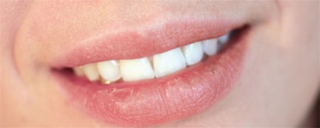 蜂蜜涂嘴唇能不能过夜，蜂蜜涂嘴唇可以过夜吗