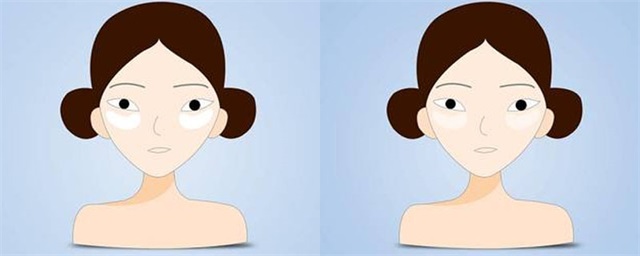 为什么贴眼膜缓解眼疲劳