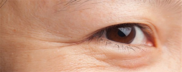 改善眼部皱纹的方法，如何减少眼部皱纹