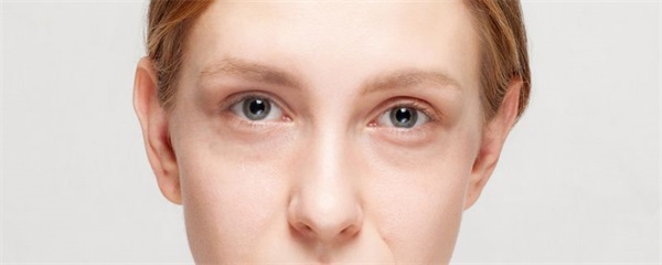 黑眼圈眼影的画法，黑眼圈该怎么画眼影