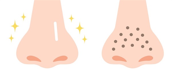 黑头导出液的副作用，黑头导出液的危害