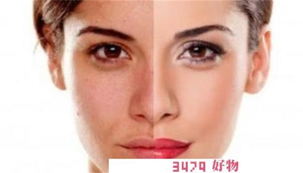 怎么去黄皮肤，暗黄皮肤怎么改善