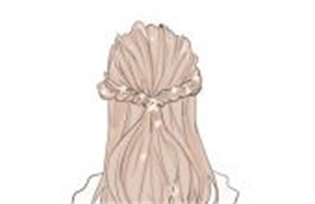 主要在以下几个方面，小孩子长雀斑的原因是什么