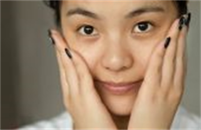 ​哪些是雀斑引发的具体因素，雀斑引发具体因素是什么呢