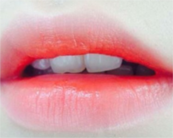 避免雀斑加深，小孩子有雀斑怎么去掉比较好