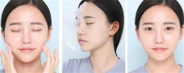 敏感性皮肤要注意什么，敏感性皮肤的护理方法