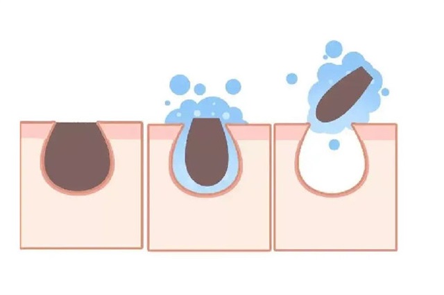 去黑头洗面奶什么牌子好，去黑头洗面奶排行榜前十名