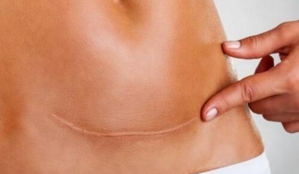 百洛油的功效，百洛油的隐藏技能