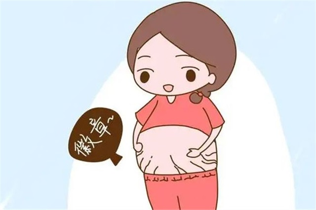 妊娠纹激光手术多少钱，妊娠纹用激光可以去除掉吗