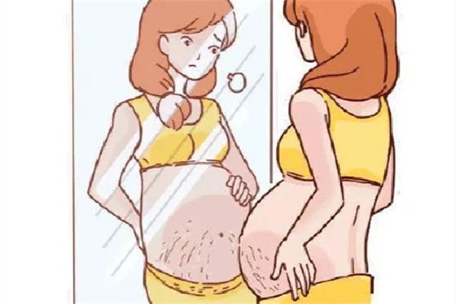 妊娠纹是怎么引起的，妊娠纹怎么可以彻底消除
