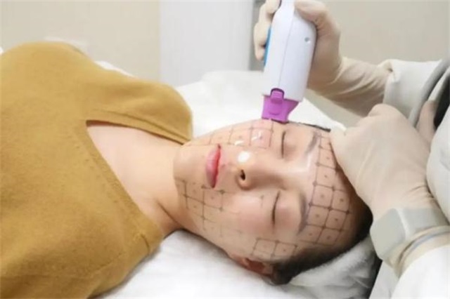 热玛吉是什么美容项目，热玛吉是什么原理