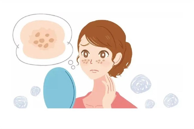 皮秒祛斑会让角质层变薄吗，皮秒祛斑能保持几年