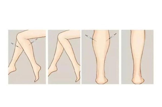 瘦腿针对身体有伤害吗，瘦腿针对脂肪腿有效果吗