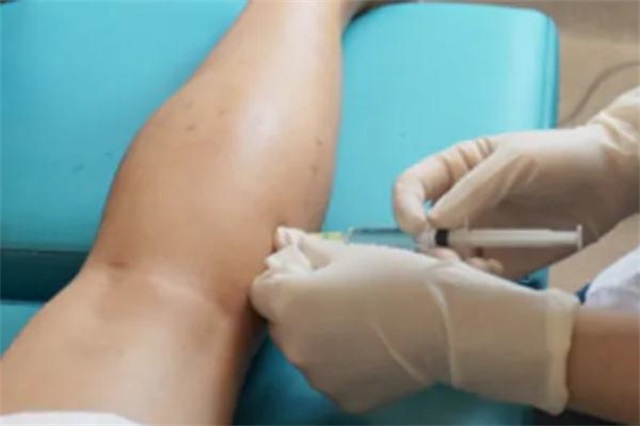 瘦腿针的危害有什么副作用，瘦腿针的原理