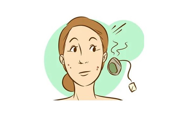 祛疤手术是不是越早做效果越好，祛疤手术大概需要多久恢复