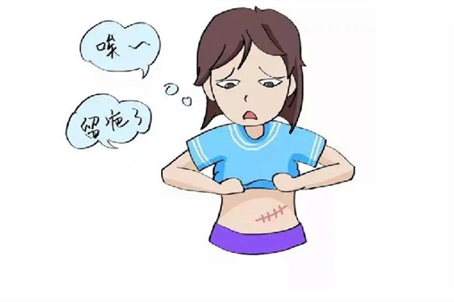 祛疤手术按什么收费，祛疤手术大概要多少钱