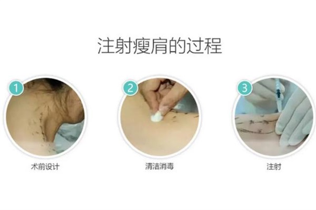 瘦肩针打完可以平躺吗，瘦肩针会不会手臂没力气