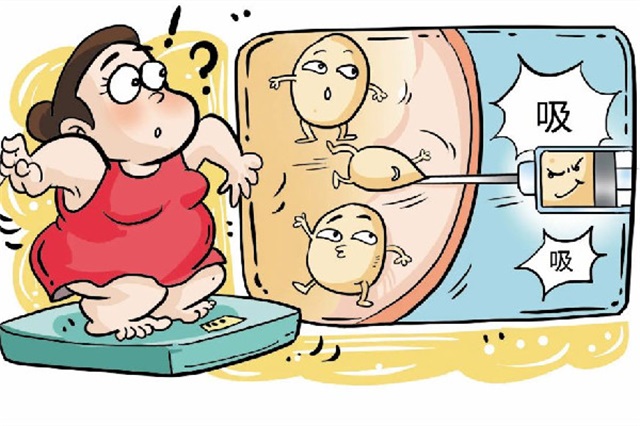 吸脂一次最多吸多少，吸脂手术大概要多少钱