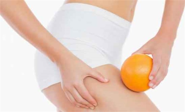 肥胖纹预防方法，肥胖纹怎么消除