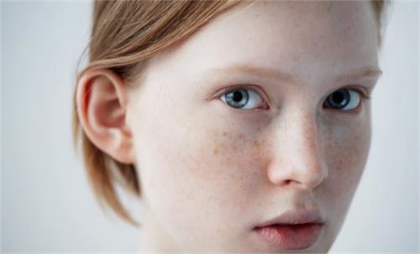 自制面膜赶走恼人斑点，女人长斑久治不愈老反复