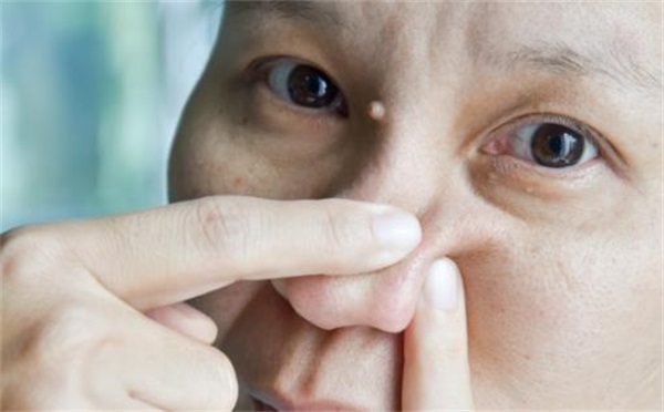 用珍珠粉去黑头效果好不反弹，教你轻松消灭鼻头黑头