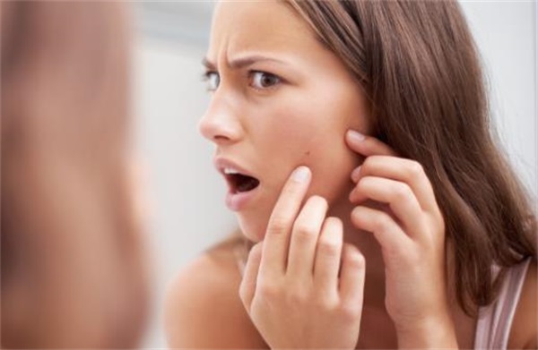正确祛除粉刺的方法，不良生活习惯会长粉刺