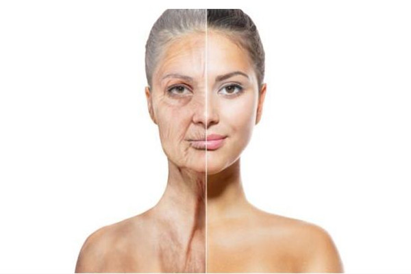 除皱针打完后有什么反应，除皱针打完笑容僵硬多久能恢复