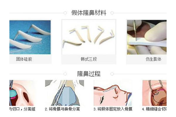 膨体隆鼻可以维持多少年，膨体隆鼻可以一辈子不取出来吗