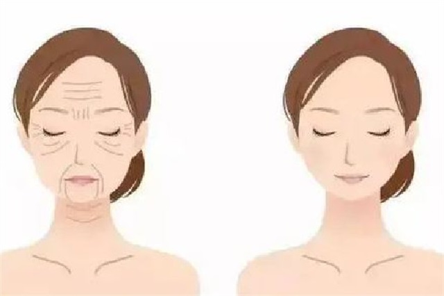 光子嫩肤会留疤吗，光子嫩肤掉痂后红印怎么办