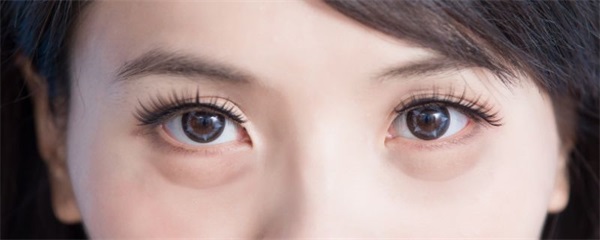 如何去眼袋，9个去眼袋的小妙招