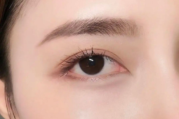 激光洗眉疼痛感多久消失，激光洗眉是第一次疼还是第二次疼